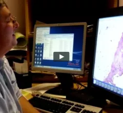 The Adoption and Benefits of Digital Pathology for Primary Diagnosis