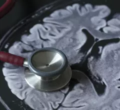 an MRI brain scan and a stethoscope