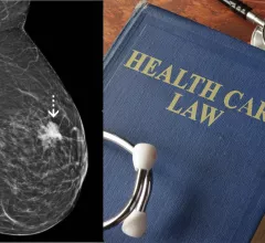 The most popular radiology business stories in February 2022 included several lawsuits pertaining to imaging centers and radiology companies and a new study suggesting not to delay mammograms in women who were recently vaccinated against COVID-19.