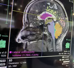 Brain MRI AI assessment and segmentation on Fujifilm's Synapse system at RSNA 2023. Photo by Dave Fornell. #RSNA #RSNA23 #RSNA2023