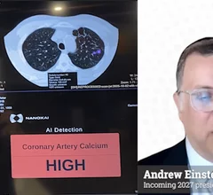 Andrew Einstein, MD, PhD, FACC, MASNC, MSCCT, FSCMR, incoming 2027 president of the American Society of Nuclear Cardiology (ASNC), professor of medicine in radiology, and director of nuclear cardiology, cardiac CT and cardiac MRI at Columbia University Irving Medical Center/NewYork-Presbyterian Hospital, discusses the potential and limitations of using coronary CT angiography (CCTA) as a screening modality. He also discusses the role of opportunistic imaging.