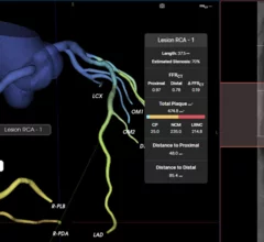 The U.S. Food and Drug Administration (FDA) granted 510(k) clearance for Elucid's FFR-IQ software for the noninvasive estimation of fractional flow reserve from coronary CT angiography (FFR-CT). The artificial intelligence (AI) based technology incorporates coronary anatomy and plaque composition into its estimation of coronary physiology for a more accurate and individualized assessment to aid in treatment decisions.