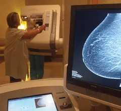 Mammography workstation at Georgia Regents Medical Center