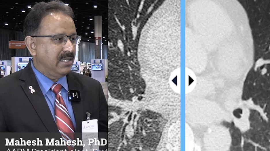 Video of Mahadevappa Mahesh, PhD, incoming-AAPM president, professor of radiology and a medical physicist, Johns Hopkins University School of Medicine, explains key trends in imaging physics presented at the Radiological Society of North America (RSNA) 2023 meeting. 