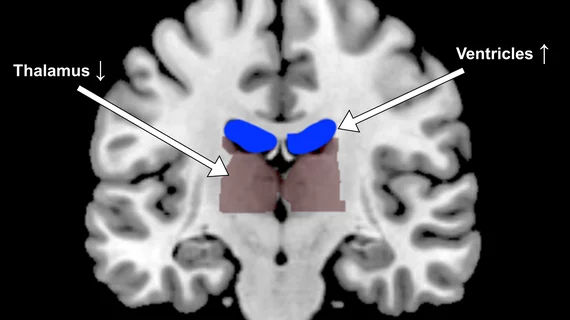 fMRI from Georgia Tech