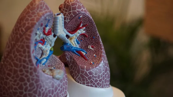 Lungs Lungs