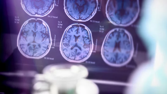 Brain Scan Brain Scan