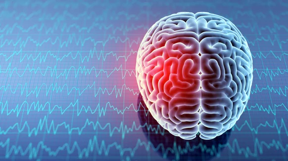 Concussion brain Concussion brain