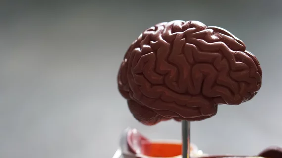 brain.jpg brain.jpg