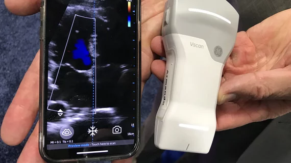 The GE healthcare vScan Air was one of several point of care ultrasound (POCUS) systems on display at the ACC 2022 meeting.